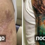20 tatuagens sobre cicatrizes e queimaduras que têm ajudado as pessoas a transformar as suas imperfeições num ponto alto
