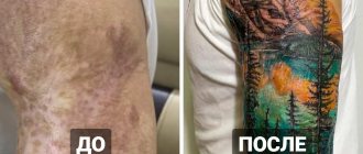 20 de tatuaje peste cicatrici și arsuri care i-au ajutat pe oameni să își transforme defectele într-un punct de atracție