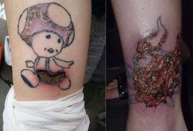 Quali sono i pericoli dei tatuaggi