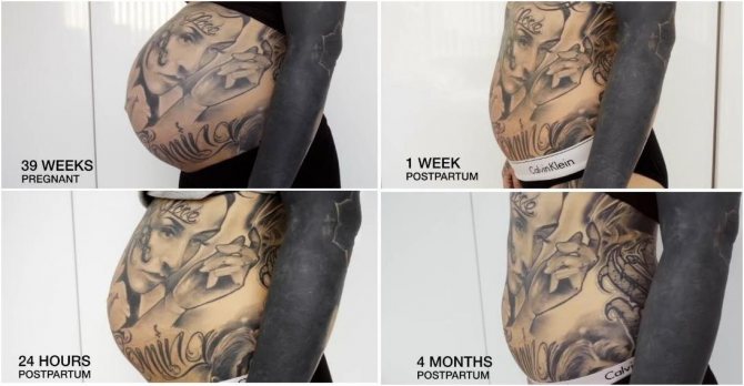 当你体重增加或减少时，纹身会发生什么变化