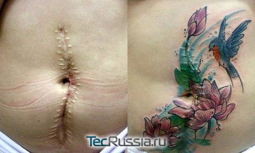 Tatuagem colorida de cicatrizes