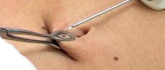 Foto - piercing do umbigo