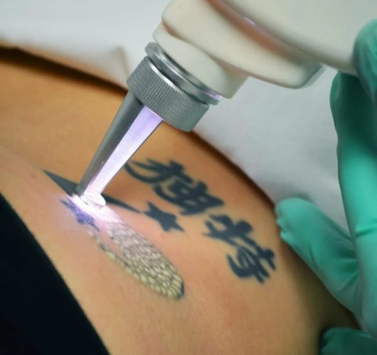Kur skauda gauti tatuiruotę ant mergaitės kūno?