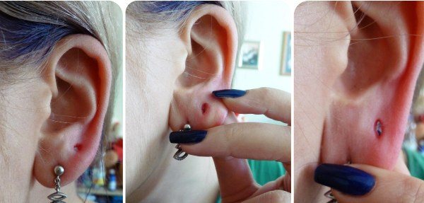 Ako vytvoriť a utiahnuť tunely v ušiach