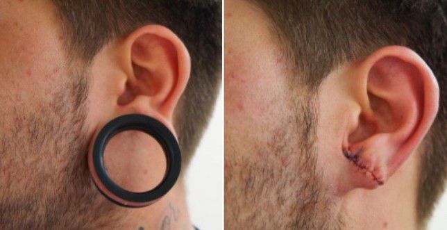 Hvordan man laver tunneler i ørerne pleje komplikationer