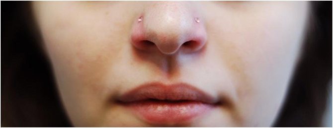 Πώς να κρύψετε ένα piercing στη μύτη με ασφάλεια