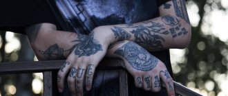 Miten poistaa tatuointi?