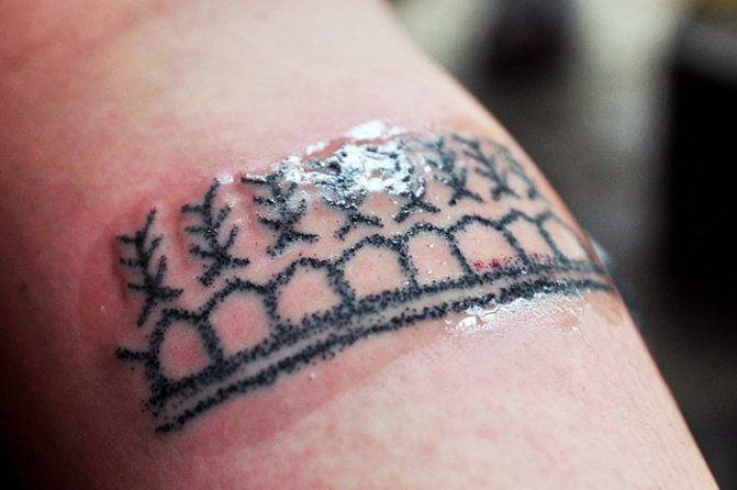 Докато кората се спуска върху татуировката. Лечение на татуировки през деня, снимка.