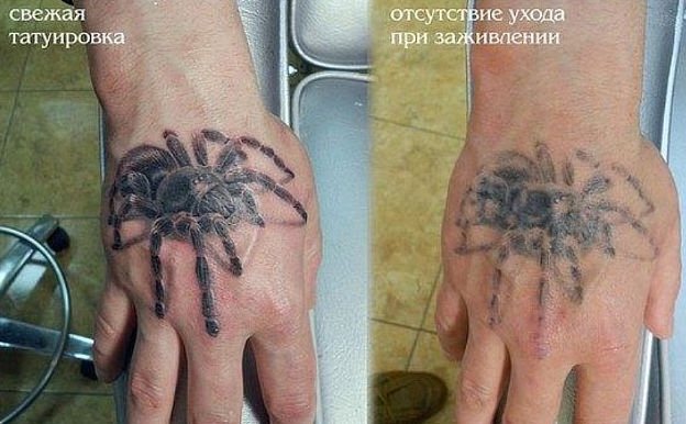Ahogy a tetoválásról leválik a hámréteg. Tetoválás gyógyulás nappal, fotó