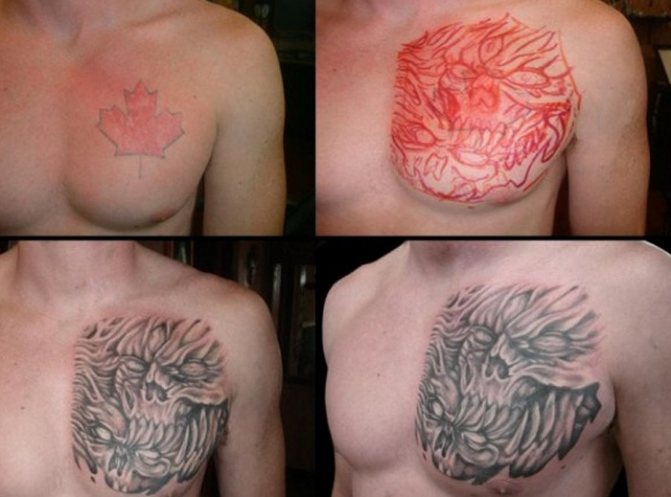 Come rimuovere un tatuaggio senza una cicatrice