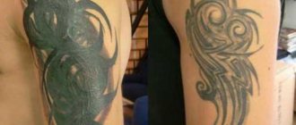 Tetoválás korrekció