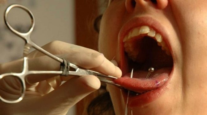 Procedura di piercing alla lingua