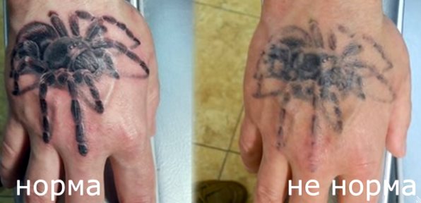 Cuidados incorrectos com tatuagens