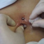Piercing kezelés