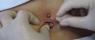 Trattamento del piercing
