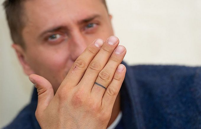 Павел Радучни премахва татуировка от врата си