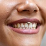 Piercing under overlæben (smil) på frenulum. Fotos, konsekvenser, anmeldelser