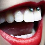 Piercing under overlæben (smiley) på frenulum. Fotos, konsekvenser, anmeldelser