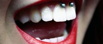 Σκουλαρίκι κάτω από το άνω χείλος (χαμόγελο) στο frenulum. Φωτογραφίες, συνέπειες, κριτικές