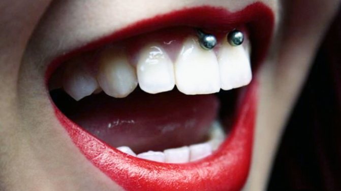 Piercing sub buza superioară (zâmbet) pe frenulum. Fotografii, consecințe, comentarii