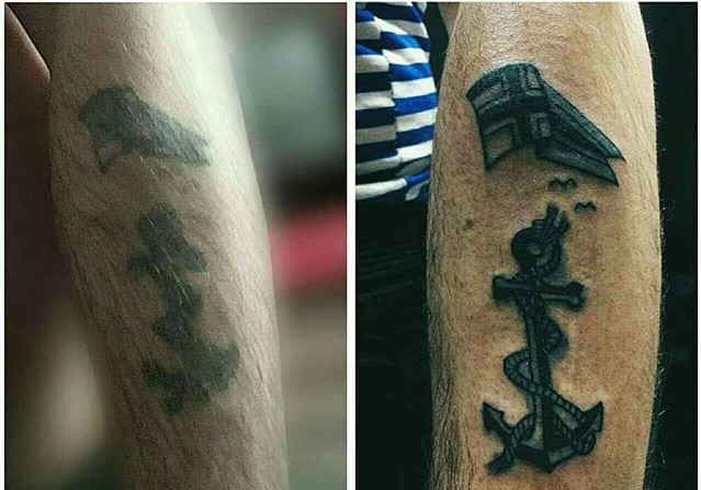 Tetoválás helyreállítása