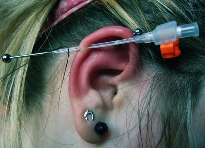 Rod in the ear. Photo of industrial, what is the name, how long does it overgrow, where to buy, price