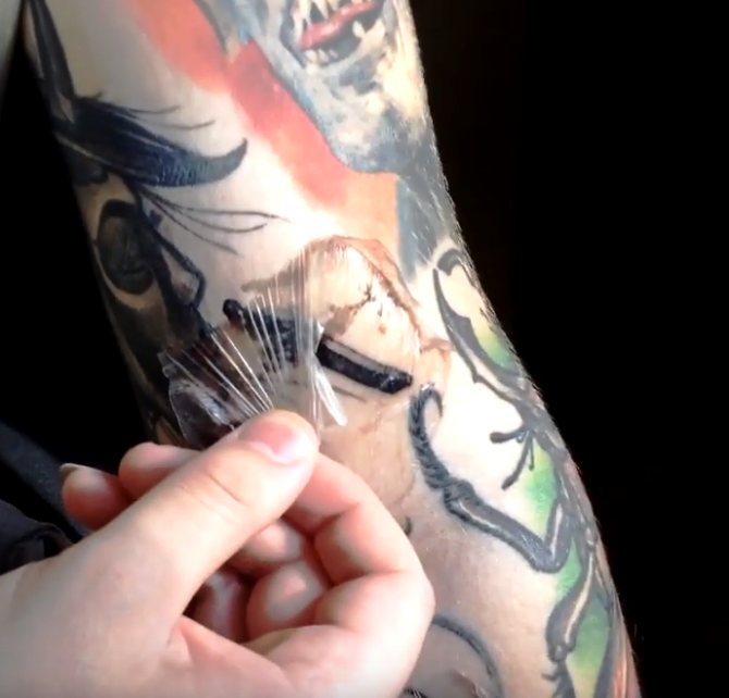 Genezing tatoeage film verwijdering