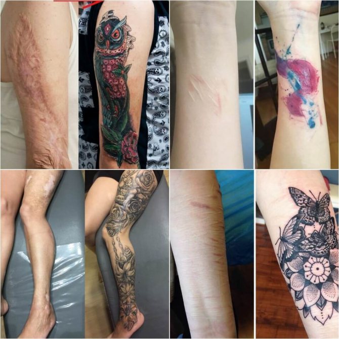 Tatoveringer på ar - Tatoveringer på ar - Tatoveringer på ar - Tattoos på ar - Skjuler på ar