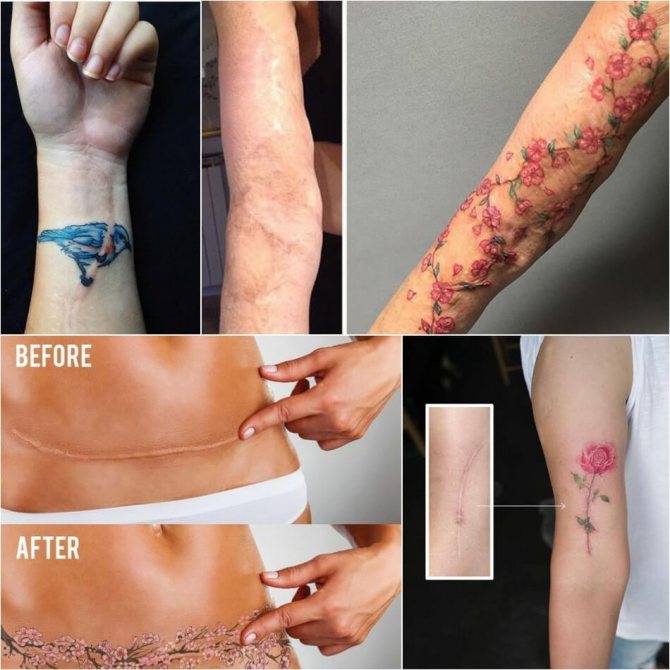 Tatuagens em cicatrizes - Tatuagens em cicatrizes - Tatuagens em cicatrizes
