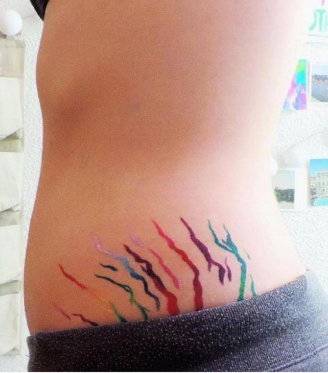 Tatuiruotė ant pilvo po strijų