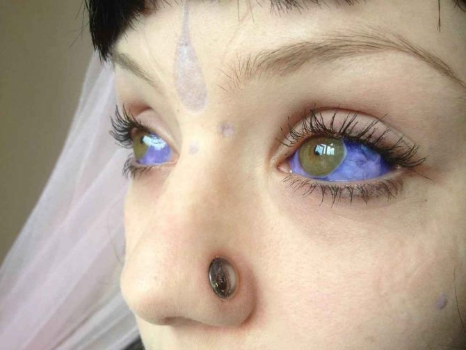 tetovanie očnej gule