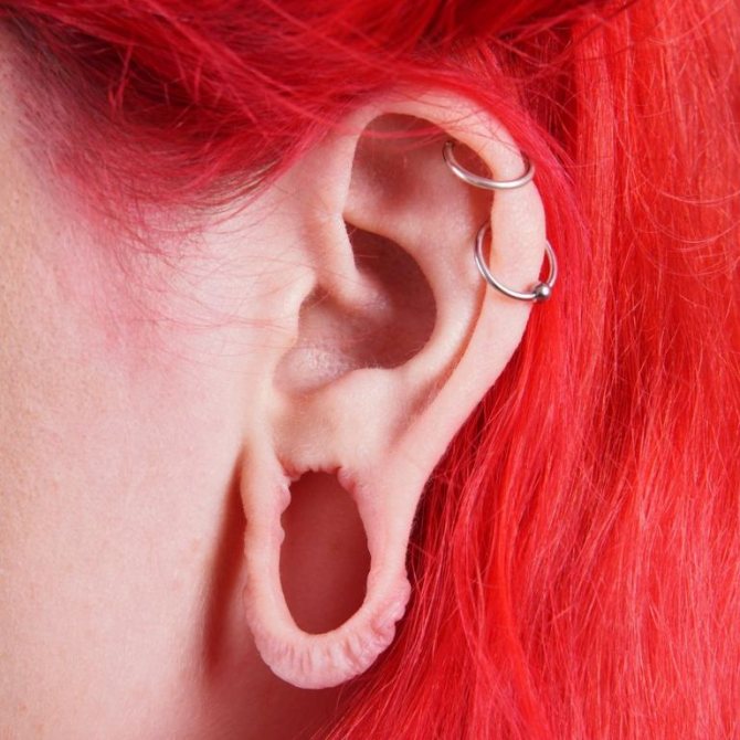 túneis nos seus ouvidos consequências