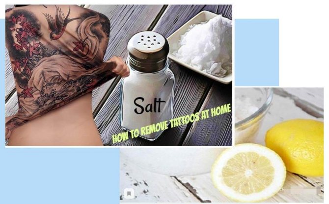 Премахване на татуировки от сол