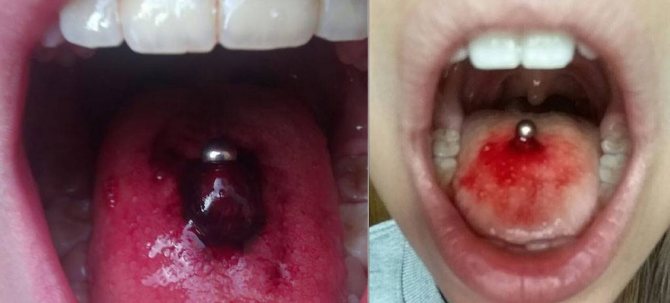 Tudo sobre o piercing da língua: piercing, cuidado, consequências