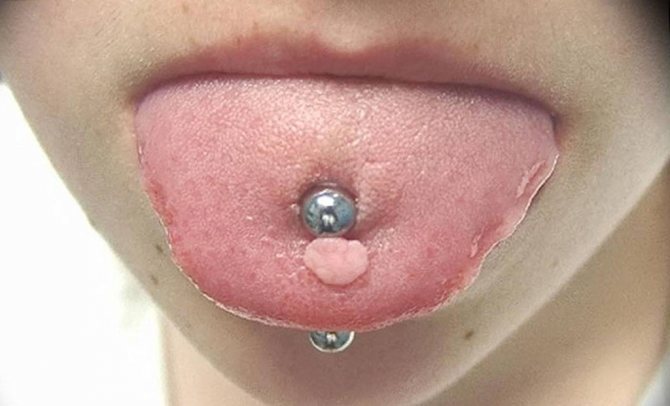 Všetko o piercingu jazyka: piercing, starostlivosť, možné následky