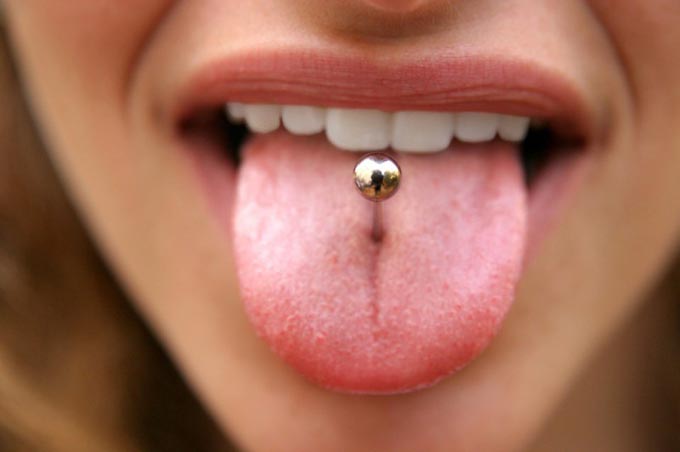 zarastený piercing jazyka